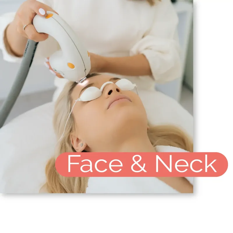 IPL Photofacial