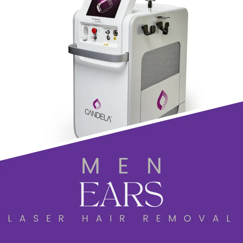 EARS - Men Laser Hair Removal with GentleMax Pro PLUS