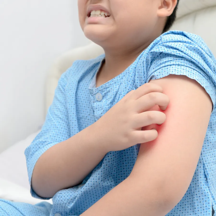 Child scratching an itchy red rash on the arm