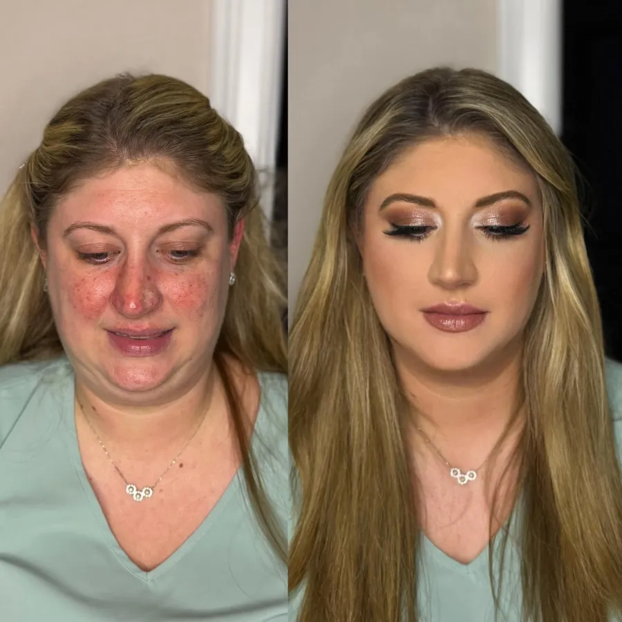 Before and after: facial redness evened out with full glam makeup and softly curled hair