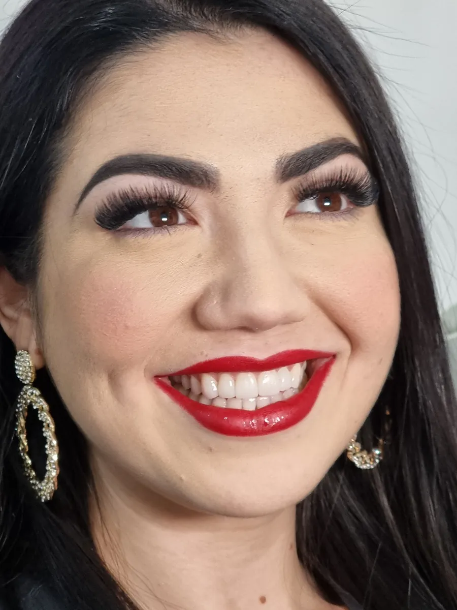 Paciente sonriendo después de su diseño de sonrisa