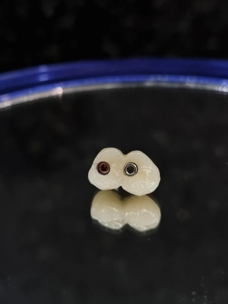 Puente sobre implantes