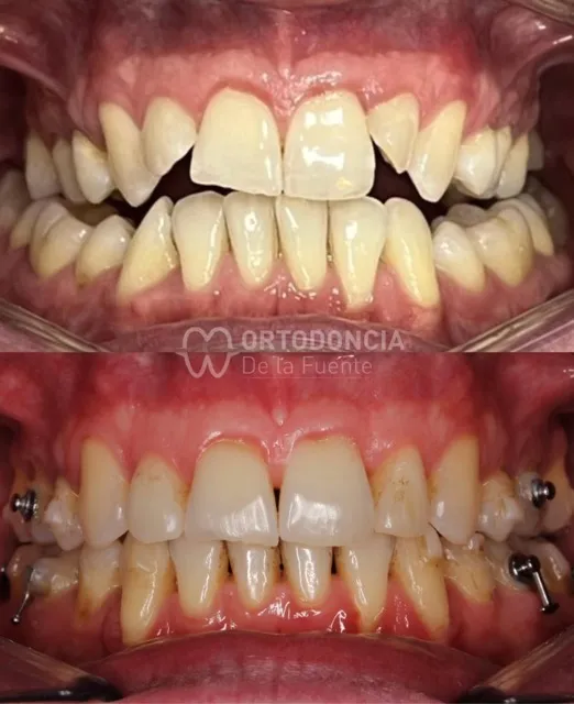Resultado de paciente 3