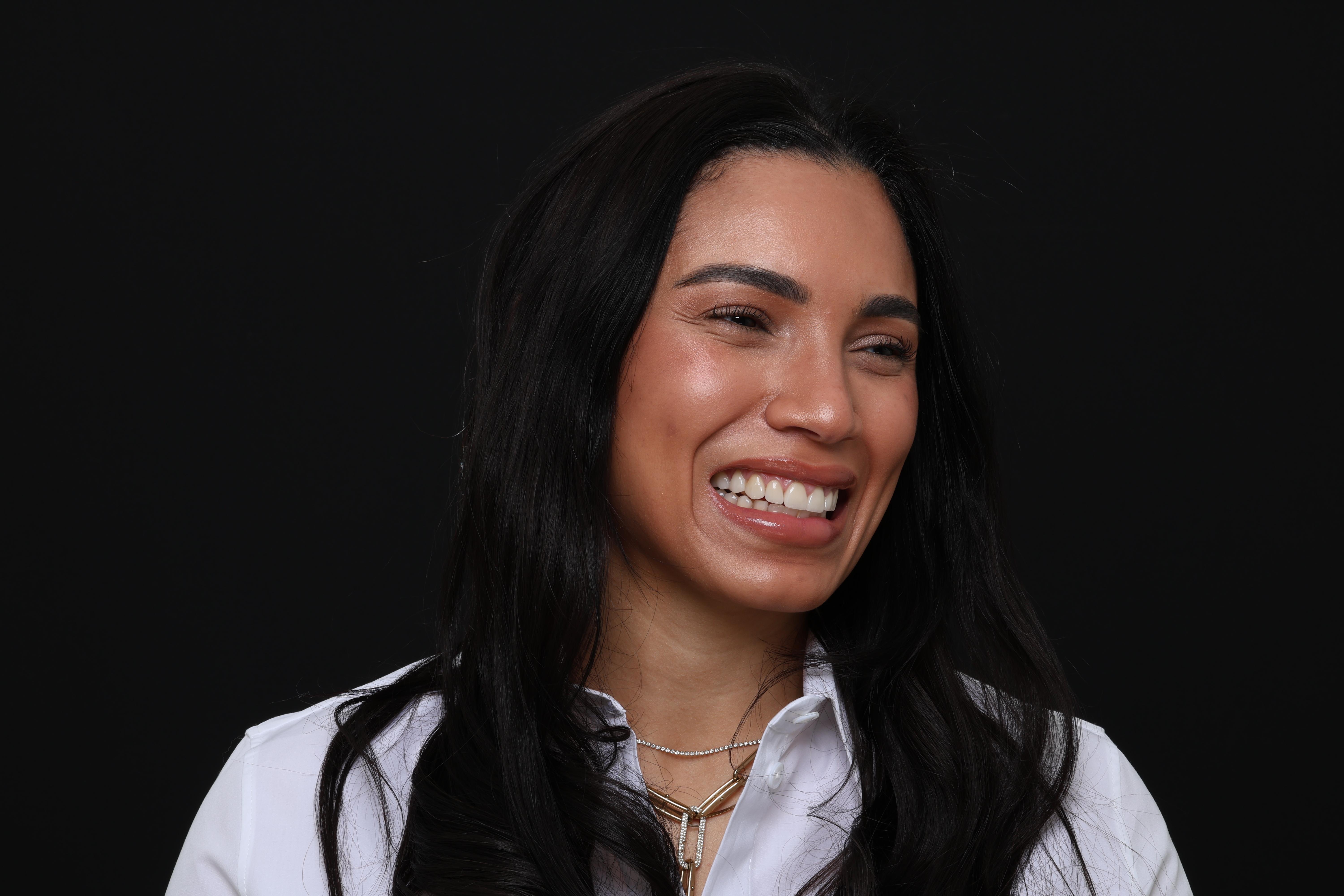 Raquel P. veneers result
