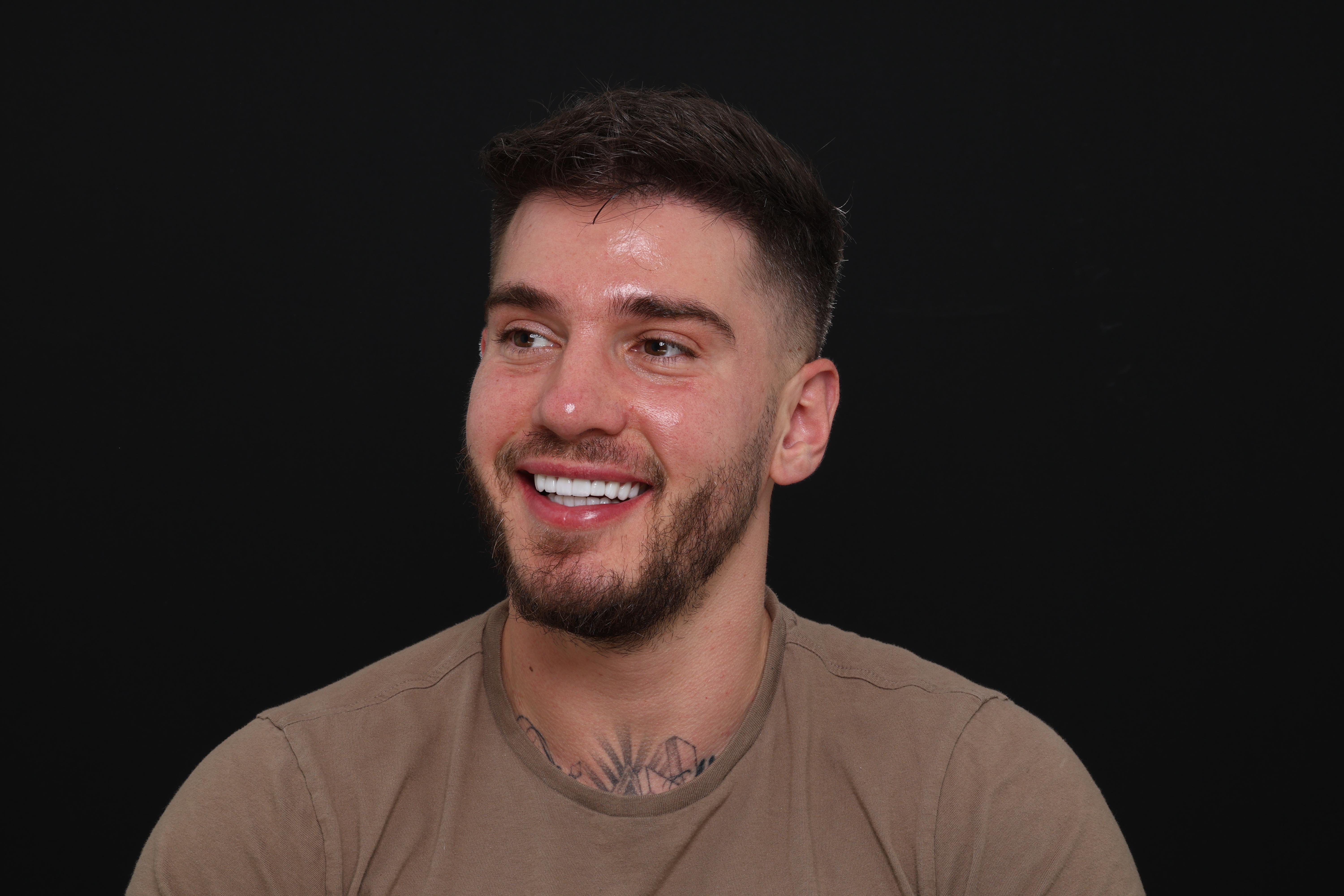 Kyle S. veneers result
