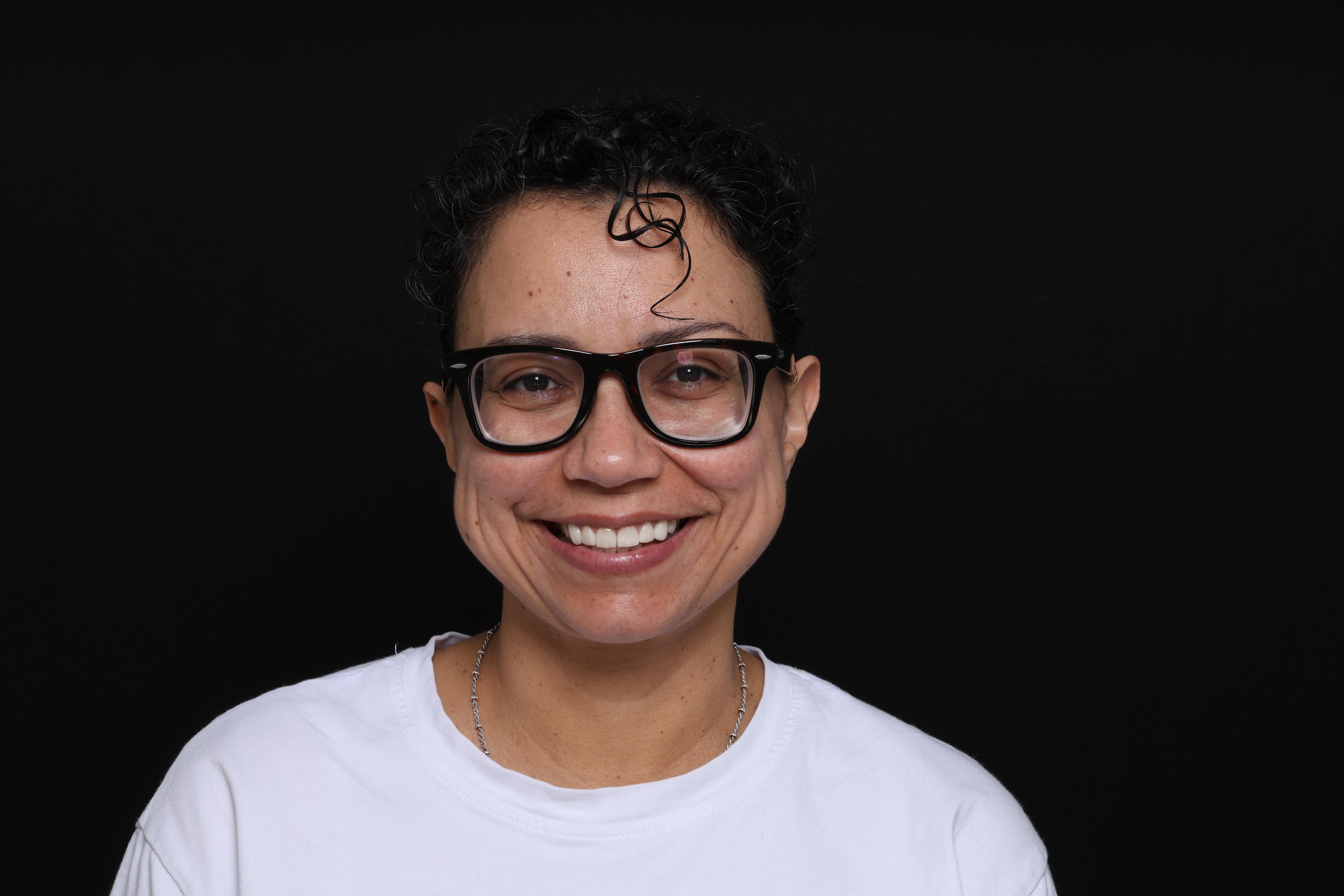 Gisela D. veneers result