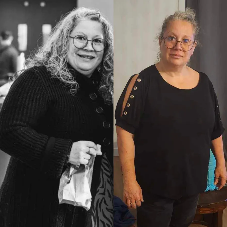 Transformation avant-après