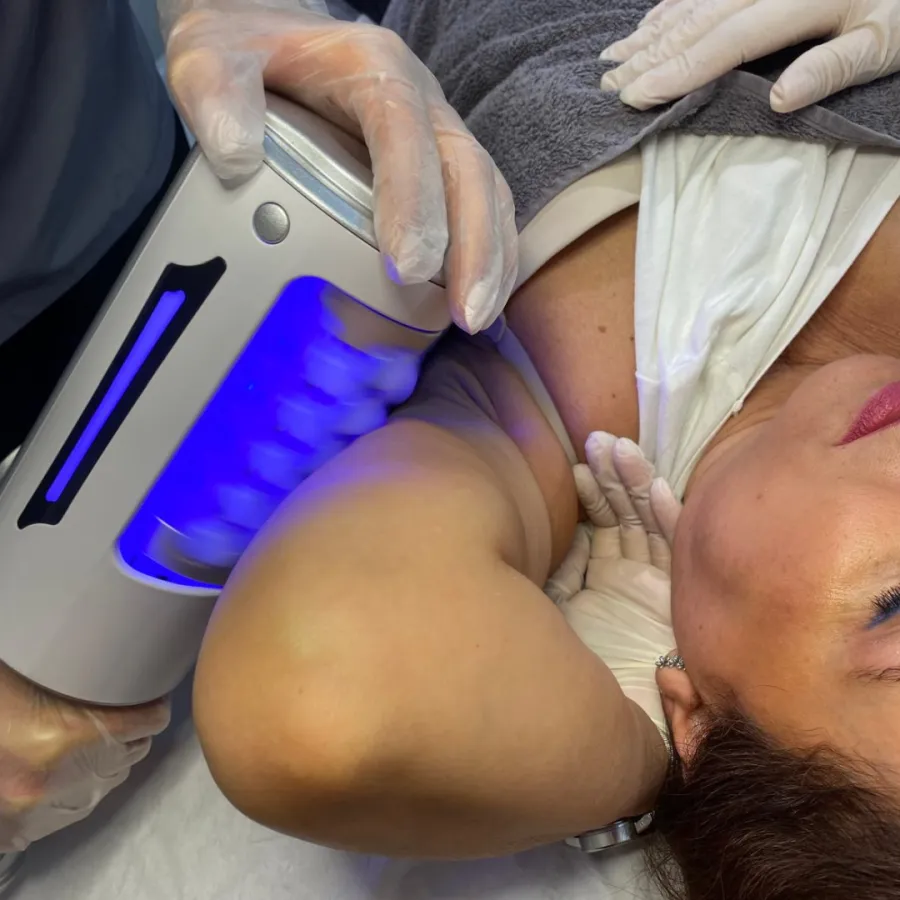 Endosphere cellulite reduction treatment on thighs