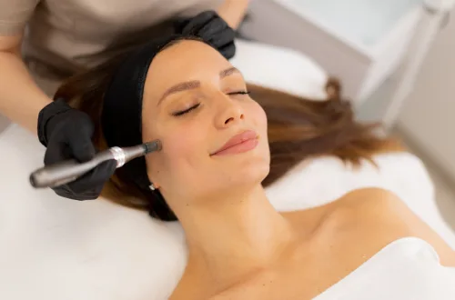 Microneedling à Démo Clinique, Ixelles
