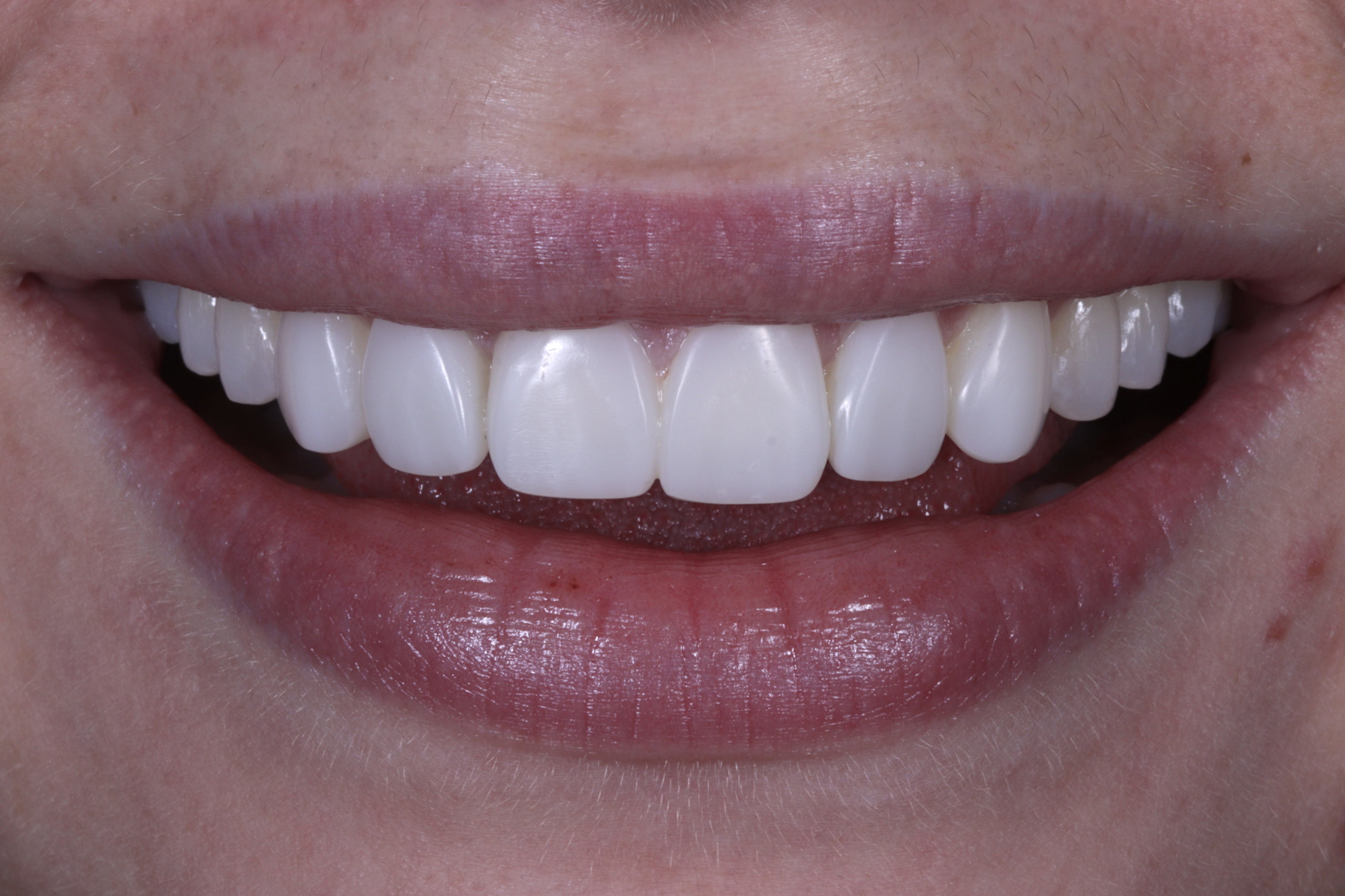 Picture 1 - Wide Smile  Please do your biggest smile possible - say the letter “e”