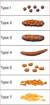 Bristol Stool Chart