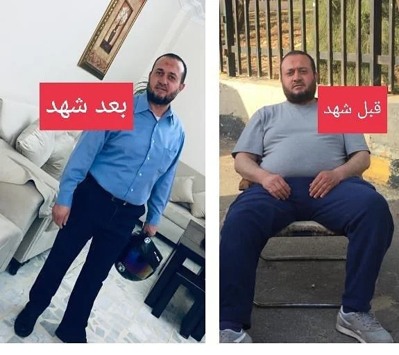 نتيجة رجل - قبل وبعد
