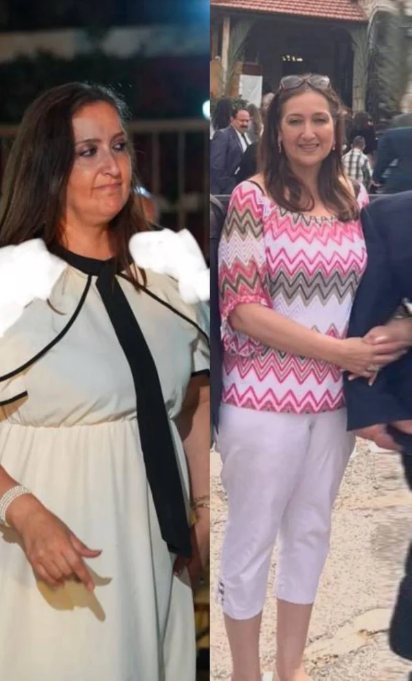 نتيجة سيدة - قبل وبعد