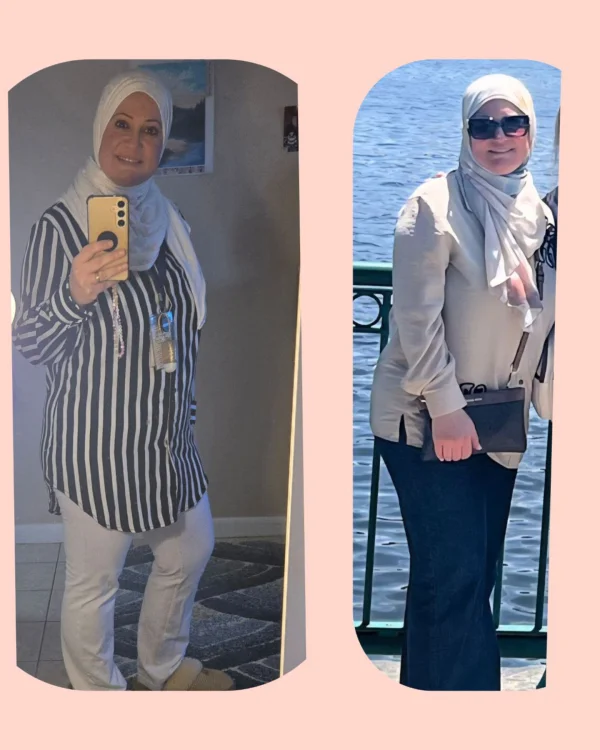 نتيجة سيدة - قبل وبعد