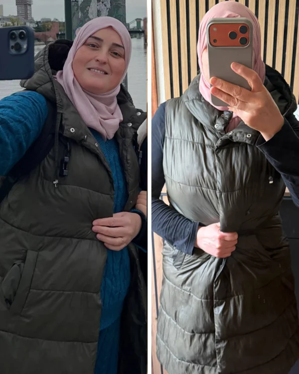 نتيجة سيدة - قبل وبعد