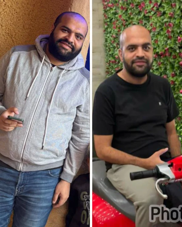 نتيجة رجل - قبل وبعد
